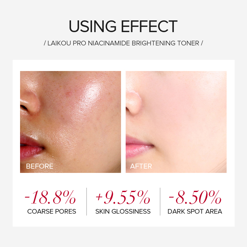 LAIKOU PRO Niacinamide 4 Parça - Korean Skincare Routine incelemesi ve fiyatı